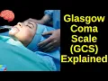 Glasgow Coma Scale GCS Explained Glasgow Coma Scale GCS Made Easy
