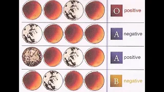 Understanding Blood Type Results Review and Practice