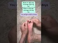 sciatica pain best solution