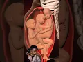 Lagu PRECIOUS MOMENTS OF TRIPLETS INSIDE THE WOMB (3D ANIMATION) 🤰#video Arjun