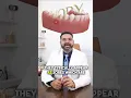 tired of Mouth ulcers watch this