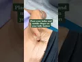 How To Check For Diastasis Recti