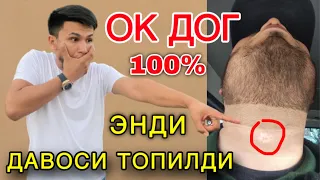 😱Мана Сизга Янгилик. Оқ Доғни ёқотиш энди жуда Осон