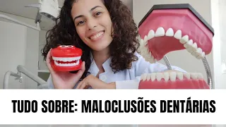 MALOCLUSÕES DENTÁRIAS - TUDO O QUE VOCÊ PRECISA SABER | MORDIDA ABERTA - DIASTEMA - CLASSE 1, 2, 3.