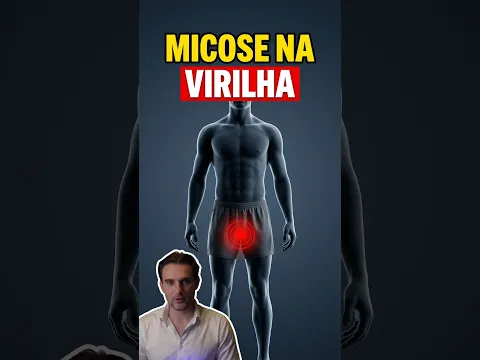 Coceira na Virilha: A Micose Que Ataca no Verão