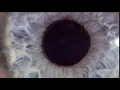 Lagu Close up of an Eye Reacting to Light, Larger Pupil After Dilation