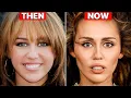 Miley Cyrus NEW Look 2024 Plastic Surgery Analysis