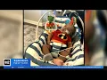 Baby in Pennsylvania receives smallest pacemaker in the world