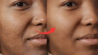 Fix & Remove Blemishes From Photos  Using Adobe Photoshop