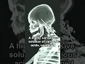 Download Lagu SCP-096 IS DEAD!!!