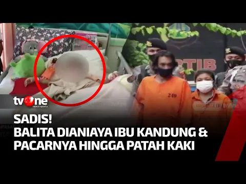 Balita di Denpasar Dianiaya Ibu Kandung dan Pacar