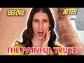 Home Laser Hair Removal Is A Lie - What Nobody Else Will Tell You IPL Hair Removal