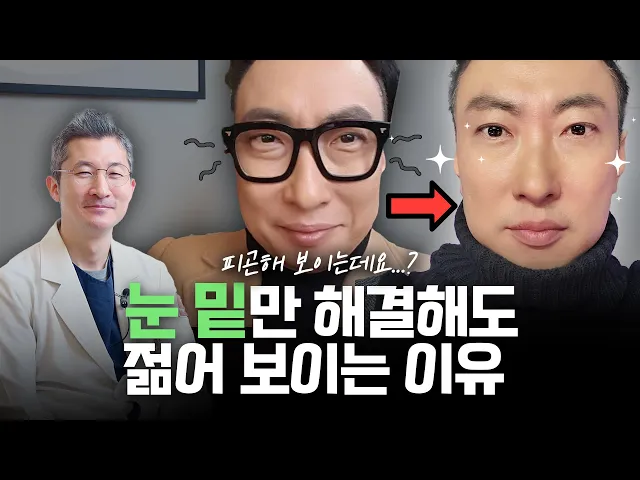 나이 들어 보이는 이유...👵🏻 만족도 높은 눈밑지방재배치와 하안검!