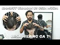 Download Lagu Cara Mengatasi Rambut UBAN Dalam Waktu 5 MENIT! GA PAKE RIBET!