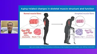  ทำไมกล้ามเนื้อถึงลดลงเมื่ออายุมากขึ้น 