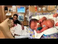 Mackenzie McKee s Journey to Parenthood with IVF Twins