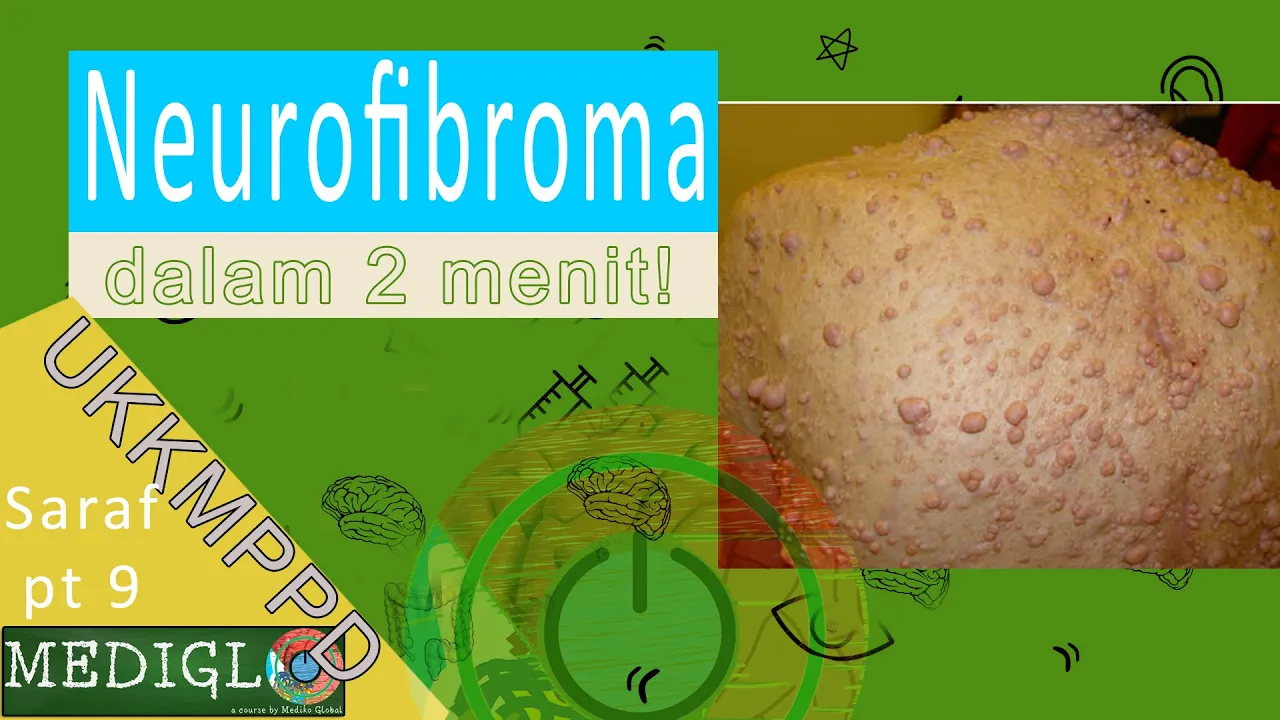 Radikulopati : HNP, Conus Medularis, Cauda Equina Syndrom - UKMPPD Sarad Mediglo.id pt 8. 
