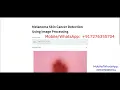 Melanoma Skin Cancer Detection Using Image Processing With Source Code Python Source Code