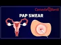 Pap Smear Cervical Cancer Screening Explained Indications Results Guidelines CanadaQBank