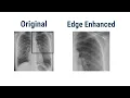 Image Filters Smoothing Filter Edge Enhancement Filters