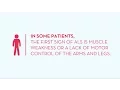 Download Lagu Signs and Symptoms of ALS