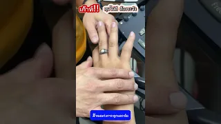  ทำไมคนไข้ที่มีประวัติเป็นเก๊าทเรื้อรังถึงมีอาการปวดบวมที่นิ้วก้อย 