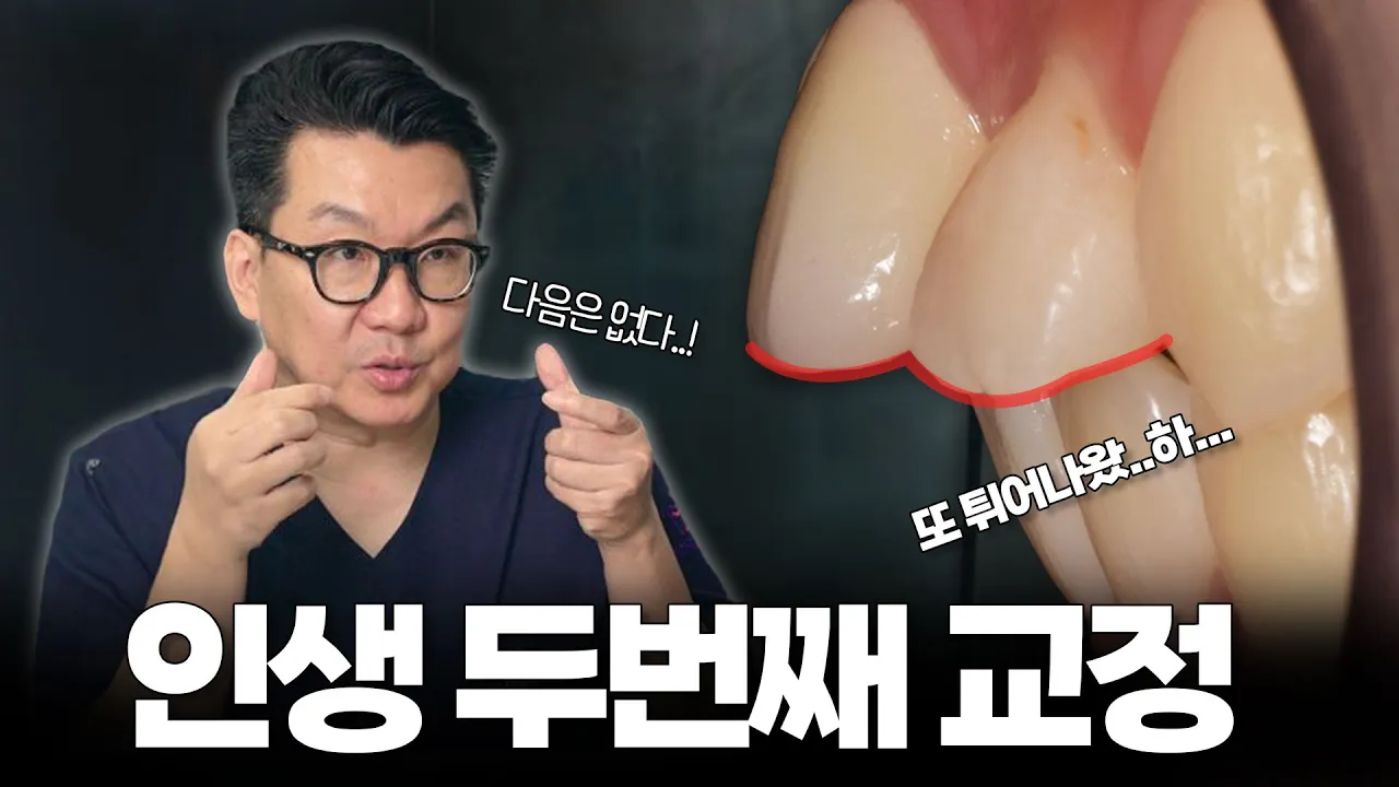 재교정으로 나온 입을 또 개선할 수 있을까?