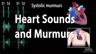 Download Heart Sounds and Heart Murmurs, Animation. MP3