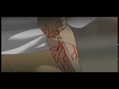 TECHNOTISE ANIME TRAILER