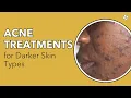 Acne Treatments for Darker Skin Types Skin Body Concerns