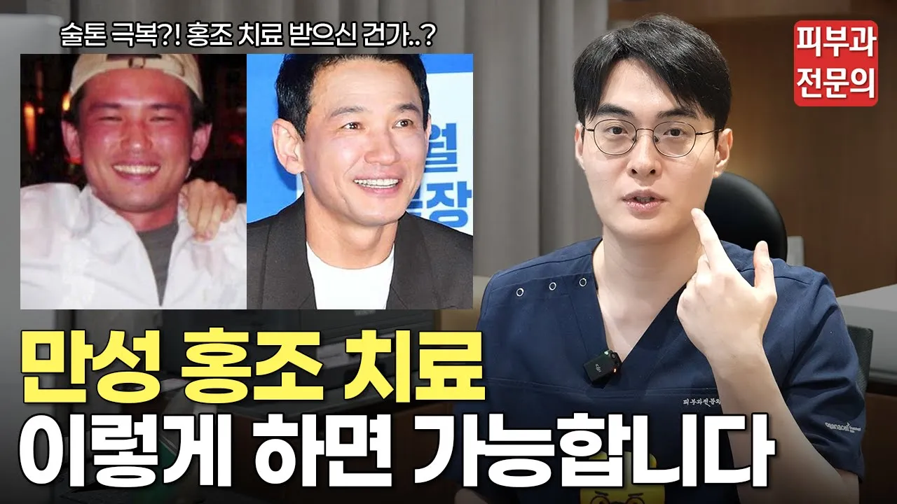 안면홍조 없애는법? 이렇게 하면 됩니다!ㅣ홍조 없애는 방법, 홍조 치료, 안면 홍조, 얼굴 홍조, 브이빔, 브이빔 퍼펙타, 마곡 피부과