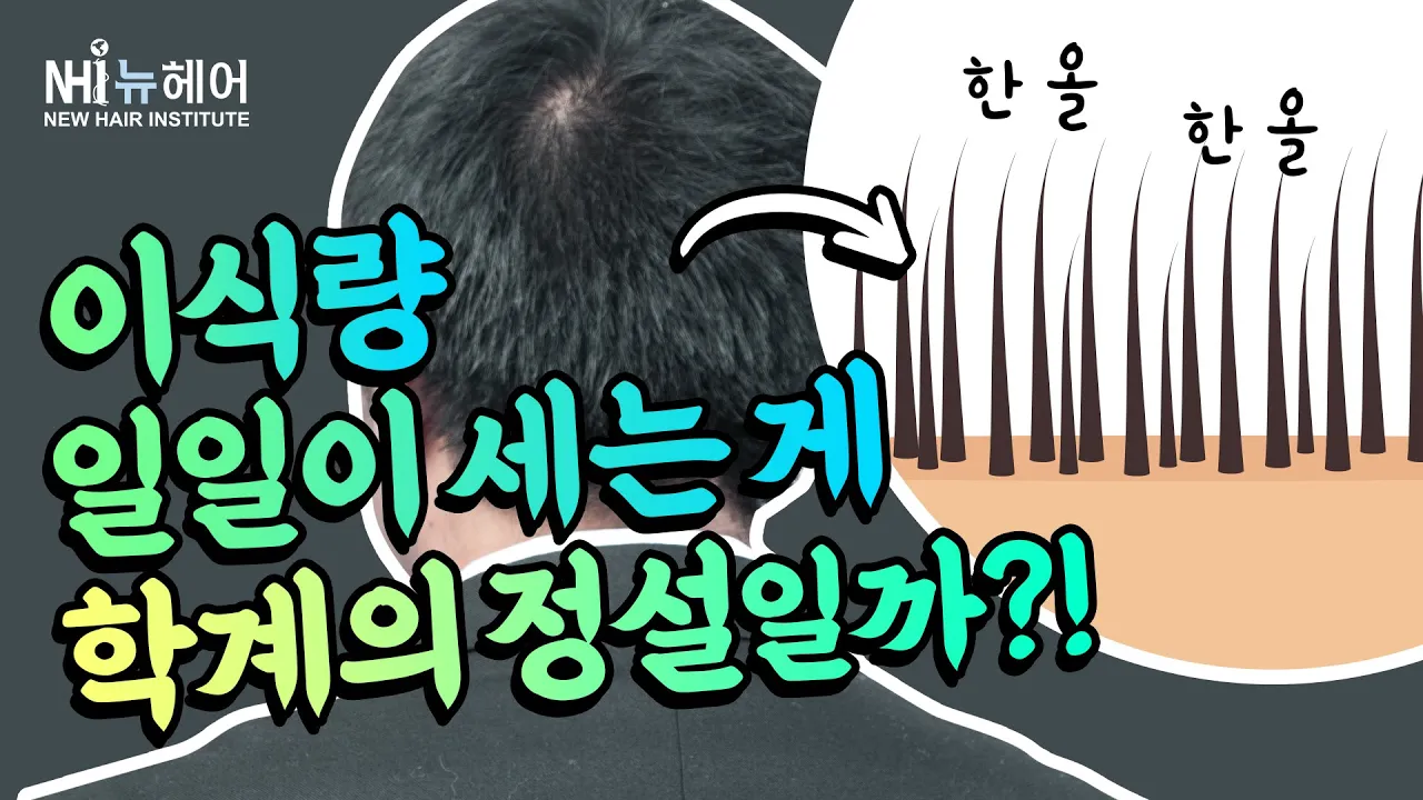 모발이식 이식량 측정방법 - 뉴헤어 I 모발이식