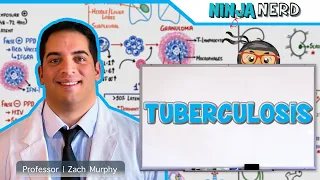 Tuberculosis