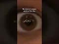 When migraines with aura strike