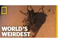 Download Lagu Larva Removed from a Girl's Scalp | World's Weirdest