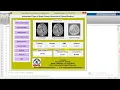 Types of Brain Tumor Detection and Classification Using Matlab Project Code Brain Tumor Prediction