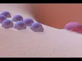 Bone Remodeling