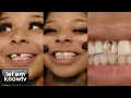 Blueface Finally Got His Girl Chrisean Rock To Fix Her Missing Tooth This Is What She Did