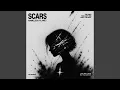 Scars