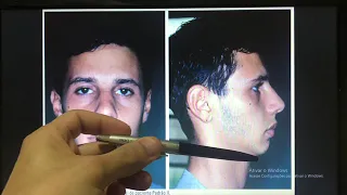 Classificação de Padrão Facial
