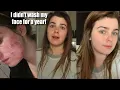 I went an entire year without washing my face cystic acne journey
