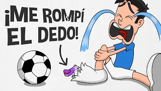 Me ROMPÍ el DEDO jugando Futbol - Batakomics ⚽️
