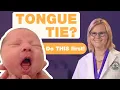Download Lagu Is Tongue-Tie Surgery Right for Your Baby? Expert Advice for Parents | AAP