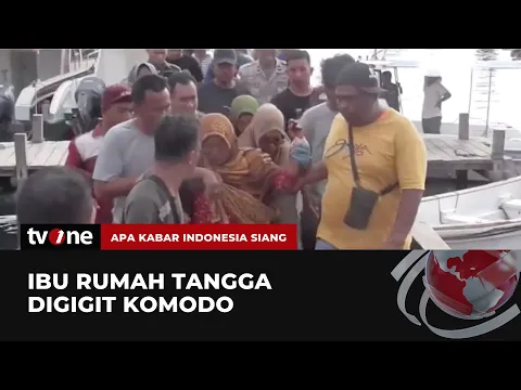 Duduk di Teras Rumah, Ibu Rumah Tangga Digigit Komodo