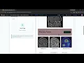 AI-Powered Brain Tumor Detection using Deep Learning
