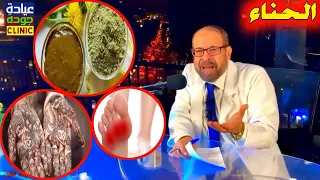 الحناء كنز لازم نرجع نستخدمها تانى علاج ببلاش ١٤ دكتور جودة محمد عواد 