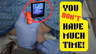 RSI PART 2: CHECKLIST, INTUBATION & POST-INTUBATION CARE