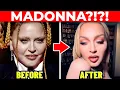 Plastic Surgeon MADONNA s Cosmetic Surgery Transformation