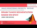 Brain Tumor Segmentation Based on SFCM using CNN Matlab
