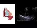 Mastering important TEE views transesophageal echocardiography